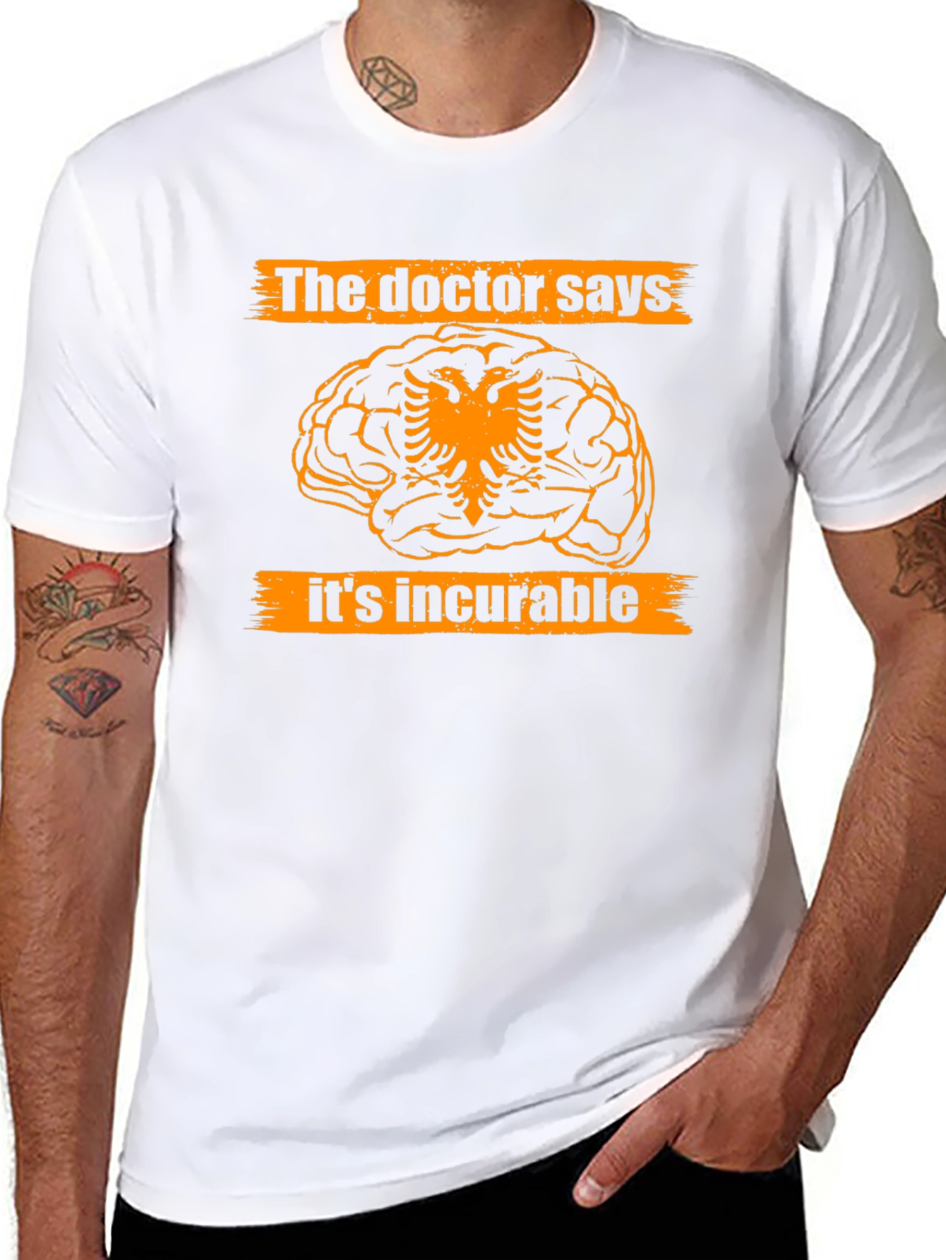 The Doctor Says Its Incurable Tee